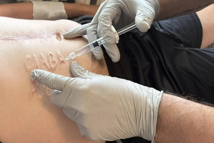 Lekarze pomogą żołnierzowi pozbyć się przerażającego napisu wykonanego przez Rosjan na ciele